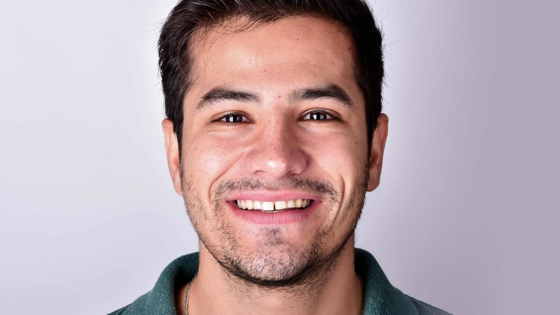 A young man smiling and showing his teeth before Digital Smile Design dental treatment